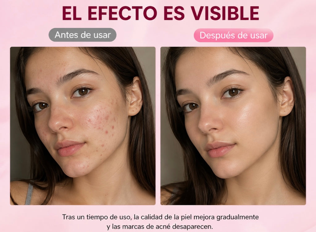 VIORÉ™ Rejuvenecimiento Facial LED 7 en 1